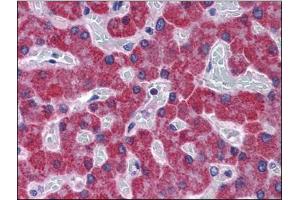 Immunohistochemistry Image: Human Liver: Formalin-Fixed, Paraffin-Embedded (FFPE) (SCD Antikörper  (C-Term))