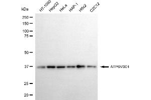 Western blotting analysis using ATP6V0D1 antibody (ABIN7797697).