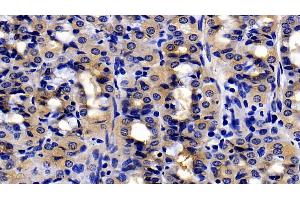 Immunohistochemistry (IHC) image for anti-Urocortin 2 (UCN2) (AA 20-112) antibody (ABIN7435022)