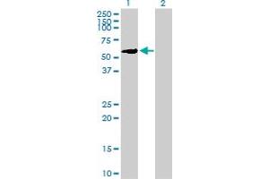 Western Blot analysis of ZNF83 expression in transfected 293T cell line by ZNF83 MaxPab polyclonal antibody. (ZNF83 Antikörper  (AA 1-516))