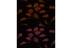 Immunofluorescence analysis of L929 cells using USP19 antibody  at dilution of 1:100. (USP19 Antikörper  (AA 1-200))