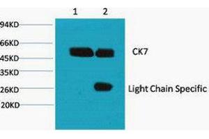 Immunoprecipitation (IP) image for anti-Keratin 7 (KRT7) antibody (ABIN3181124)