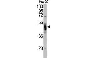 Western blot analysis of GLA antibody (N-term) in Hela cell line lysates (35 µg/lane). (GLA Antikörper  (N-Term))