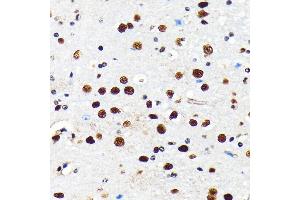 Immunohistochemistry of paraffin-embedded mouse brain using HD antibody (ABIN7267708) at dilution of 1:100 (40x lens).