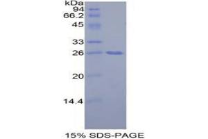 SDS-PAGE analysis of Mouse GRB7 Protein. (GRB7 Protein)