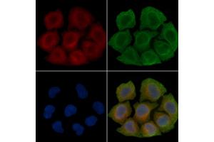 ABIN6260864 and ABIN6266508 staining Hela cells(45 min of heat-shock treatment) by IF/ICC. (Claudin 2 Antikörper  (C-Term))