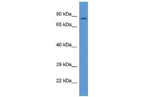 Western Blot showing PPP1R15B antibody used at a concentration of 1 ug/ml against THP-1 Cell Lysate (PPP1R15B Antikörper  (C-Term))