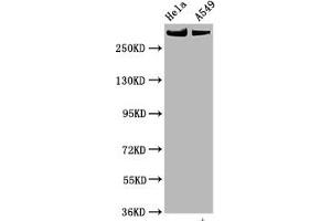 Western Blot Positive WB detected in Hela whole cell lysate,A549 whole cell lysate All lanes Phospho-MTOR antibody at 0. (Rekombinanter MTOR Antikörper  (pSer2448))