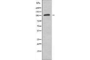 Western blot analysis of extracts from K562 cells, using RPS6KC1 antibody. (RPS6KC1 Antikörper  (Internal Region))