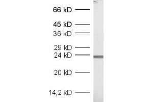 dilution: 1 : 1000, sample: recombinant protein (GFP Antikörper  (AA 183-191))
