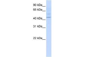 LAX1 antibody used at 1 ug/ml to detect target protein. (LAX1 Antikörper  (Middle Region))