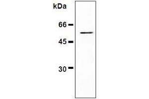 Western Blotting (WB) image for anti-Vimentin (VIM) antibody (ABIN1109487) (Vimentin Antikörper)