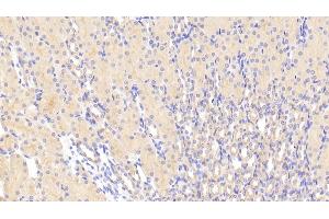 Detection of TMOD3 in Mouse Kidney Tissue using Polyclonal Antibody to Tropomodulin 3 (TMOD3) (TMOD3 Antikörper  (AA 1-352))
