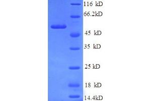 SDS-PAGE (SDS) image for Podocalyxin-Like (PODXL) (AA 32-458), (partial) protein (His tag) (ABIN1095725) (PODXL Protein (AA 32-458, partial) (His tag))