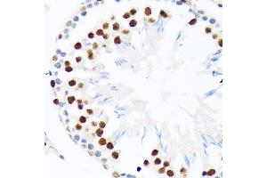 Immunohistochemistry of paraffin-embedded rat testis using PI+PI Rabbit mAb (ABIN7266879) at dilution of 1:100 (40x lens). (E3 SUMO-Protein Ligase PIAS3 (LOC101740849) Antikörper)