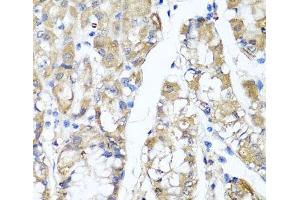 Immunohistochemistry of paraffin-embedded Human stomach using TNFAIP6 Polyclonal Antibody at dilution of 1:100 (40x lens).