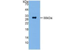 Western blot analysis of recombinant Human ADCY1. (ADCY1 Antikörper  (AA 835-1061))