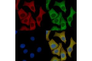 FGFR1/2 Mouse Monoclonal Antibody staining HepG2 cells by IF/ICC. (FGFR1/FGFR2 Antikörper)