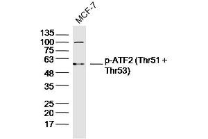 MCF-7 lysates probed with p-ATF2 (Thr51 + Thr53) Polyclonal Antibody, Unconjugated  at 1:300 dilution and 4˚C overnight incubation. (ATF2 Antikörper  (pThr51, pThr53))