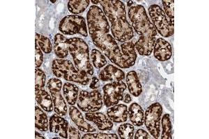 Immunohistochemical staining of human kidney with AGXT2 polyclonal antibody  shows strong cytoplasmic positivity in renal tubules at 1:50-1:200 dilution. (AGXT2 Antikörper)