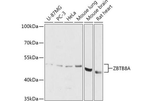 ZBTB8A 抗体  (AA 200-400)