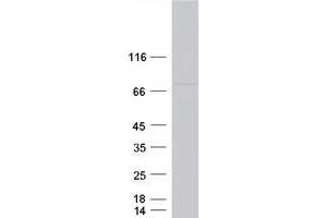 Western Blotting (WB) image for Coiled-Coil Domain Containing 93 (CCDC93) protein (Myc-DYKDDDDK Tag) (ABIN2713317)