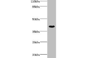 Western blot All lanes: SETD7 antibody at 4 μg/mL + MCF-7 whole cell lysate Secondary Goat polyclonal to rabbit IgG at 1/10000 dilution Predicted band size: 41 kDa Observed band size: 41 kDa (SETD7 Antikörper  (AA 1-218))