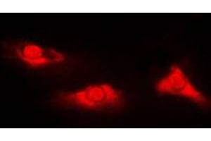 Immunofluorescent analysis of DJ-1 staining in Jurkat cells. (PARK7/DJ1 Antikörper  (Center))