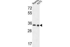 Western Blotting (WB) image for anti-Lactate Dehydrogenase A (LDHA) antibody (ABIN3004211)