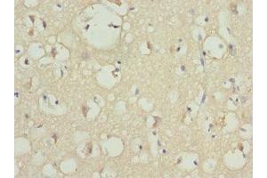 Immunohistochemistry (IHC) image for anti-Phosphatidylinositol-4-Phosphate 5-Kinase, Type I, beta (PIP5K1B) (AA 190-470) antibody (ABIN7163186)