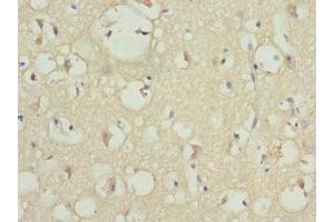 Immunohistochemistry of paraffin-embedded human brain tissue using ABIN7163186 at dilution of 1:100
