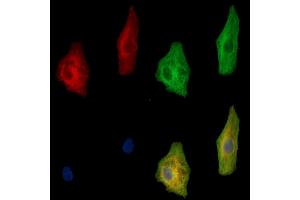 ABIN7095122 and ABIN7099178 staining  cells by IF/ICC.