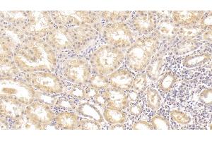 Detection of ALT in Human Kidney Tissue using Monoclonal Antibody to Alanine Aminotransferase (ALT) (ALT Antikörper  (AA 255-492))