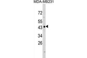 Western blot analysis of NDRG1 Antibody (N-term) in MDA-MB231 cell line lysates (35ug/lane). (NDRG1 Antikörper  (N-Term))