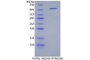 SDS-PAGE analysis of Human Furin Protein. (FURIN Protein)