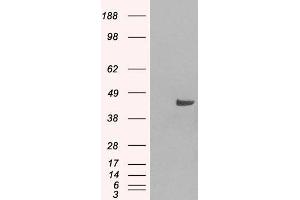 HEK293 overexpressing SNX16 (ABIN5364935) and probed with ABIN184967 (mock transfection in first lane).