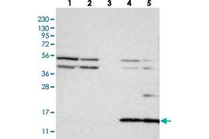 Western blot analysis of Lane 1: RT-4, Lane 2: U-251 MG, Lane 3: Human Plasma, Lane 4: Liver, Lane 5: Tonsil with CYB561D1 polyclonal antibody . (CYB561D1 Antikörper)