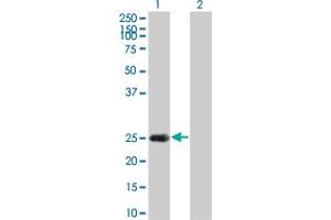 Western Blot analysis of HSPB8 expression in transfected 293T cell line by HSPB8 monoclonal antibody (M02), clone 5D7. (HSPB8 Antikörper  (AA 97-196))