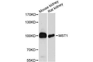 Western blot analysis of extracts of various cell lines, using MST1 antibody. (MST1 Antikörper  (AA 200-500))