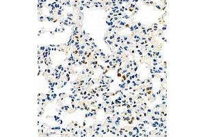 Immunohistochemistry of paraffin embedded mouse pneumonia using CCL3 (ABIN7073450) at dilution of 1:1000 (400x lens) (CCL3 Antikörper)