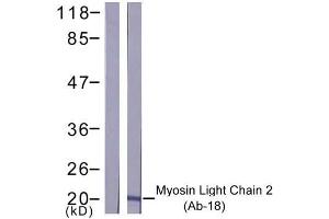 Western blot analysis of extract from K562 cells, using Myosin Light Chain 2 (Ab-18) antibody (E021157). (Myosin Antikörper)