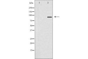 Western blot analysis of SOX6 Antibody expression in Hela cells lysates.