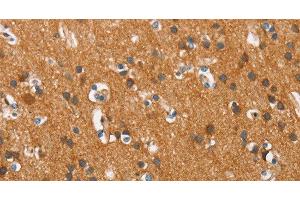 Immunohistochemistry of paraffin-embedded Human brain tissue using COX5A Polyclonal Antibody at dilution 1:40 (COX5A Antikörper)