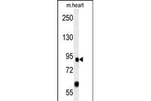 FOXP2 Antibody (C-term) (ABIN651939 and ABIN2840465) western blot analysis in mouse heart tissue lysates (15 μg/lane). (FOXP2 Antikörper  (AA 657-684))