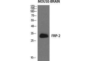 Western Blot (WB) analysis of specific cells using FRP-2 Polyclonal Antibody. (SFRP2 Antikörper  (Internal Region))