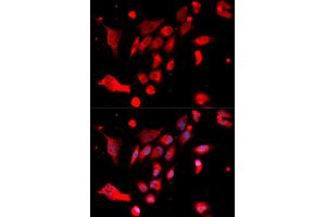 Immunofluorescence analysis of U2OS cells using MAD2L1 antibody (ABIN5970848).
