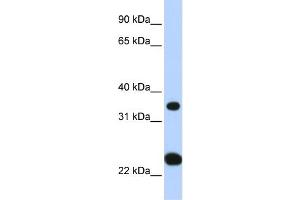 WB Suggested Anti-SLC25A35 Antibody Titration:  0. (SLC25A35 Antikörper  (N-Term))