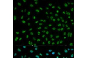 Immunofluorescence analysis of MCF-7 cells using DDB2 Polyclonal Antibody (DDB2 Antikörper)