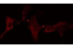 ABIN6278644 staining HuvEc cells by IF/ICC. (TMPRSS3 Antikörper  (Internal Region))