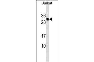 Western blot analysis in Jurkat cell line lysates (35ug/lane). (HLA-DMB Antikörper  (AA 127-154))